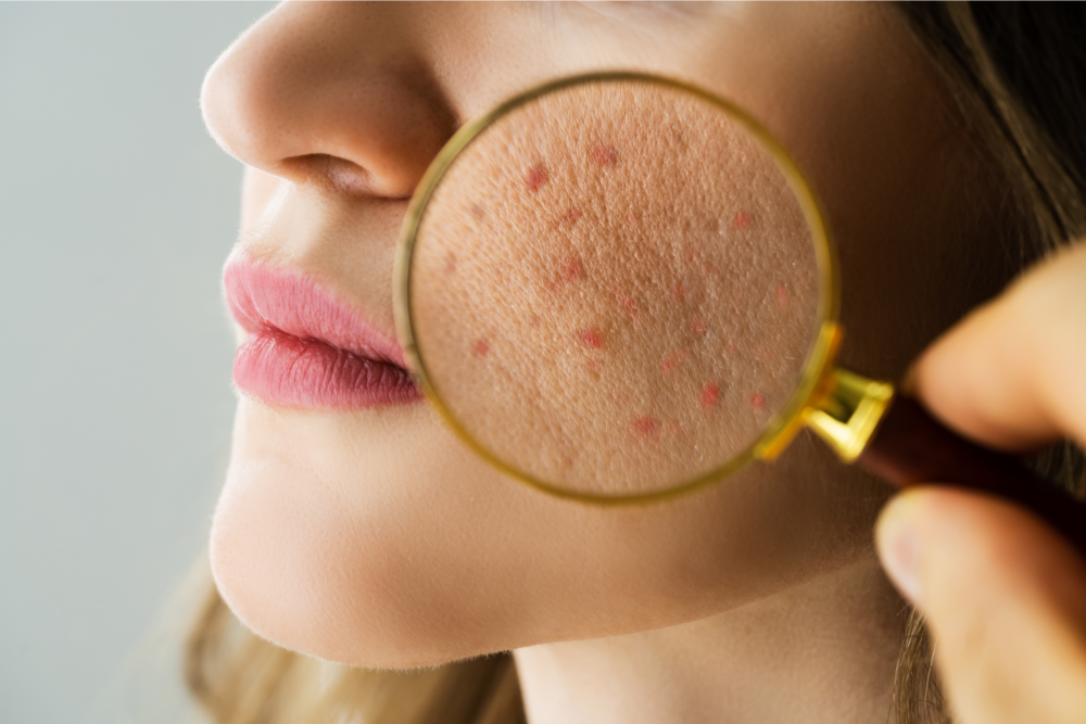 Common Skin Concerns LED Therapy Can Help Solve